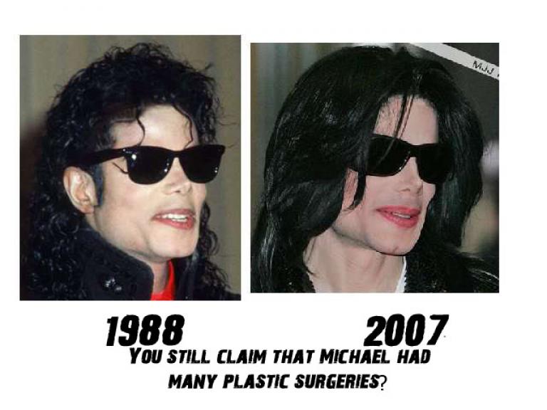 Show this to the ppl that think michael had a million plastic sugeries. Dumb losers!!!
